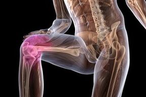 Douleurs articulaires dues à l'arthrose du genou.